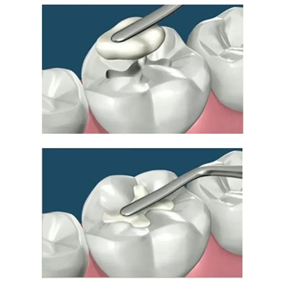 American Eagle Composite Instrument with XP Technology 9 Paddle / Paddle - AEC9TNZ