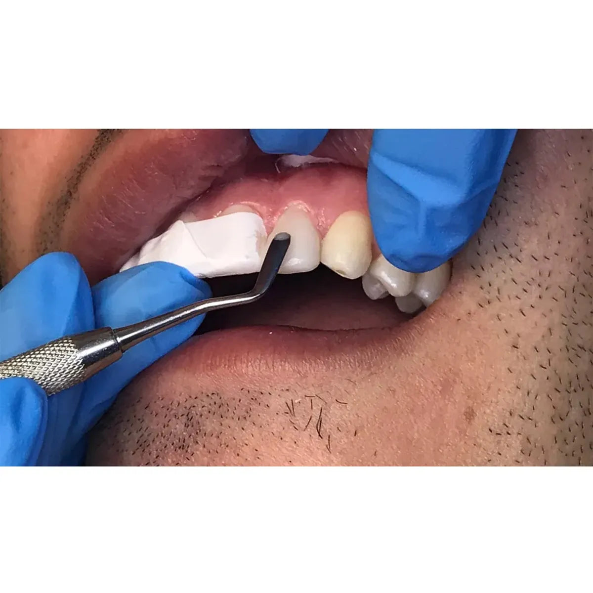 American Eagle Composite Instrument with XP Technology 9 Paddle / Paddle - AEC9TNZ