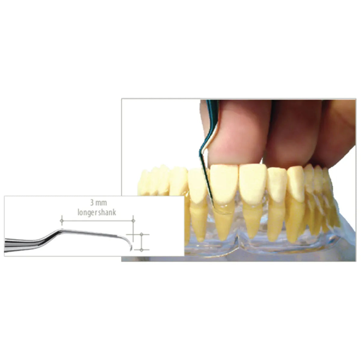 American Eagle Gracey +3 Deep Pocket (DP) Curette with XP Technology 13-14 Blue - AEGDP13-14XPX