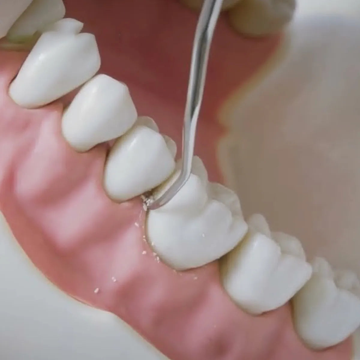 GDC Langer Curettes 1/2 For Mandibular Posterior #6 (Sl1/2)