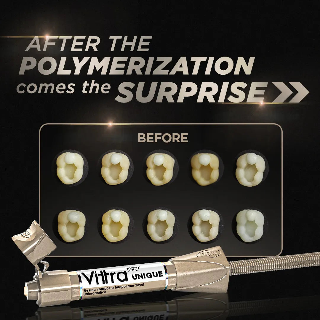 FGM Vittra APS Unique Composite