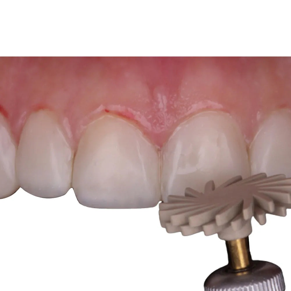 ET Dental Composite Polishing Spiral Disc Kit