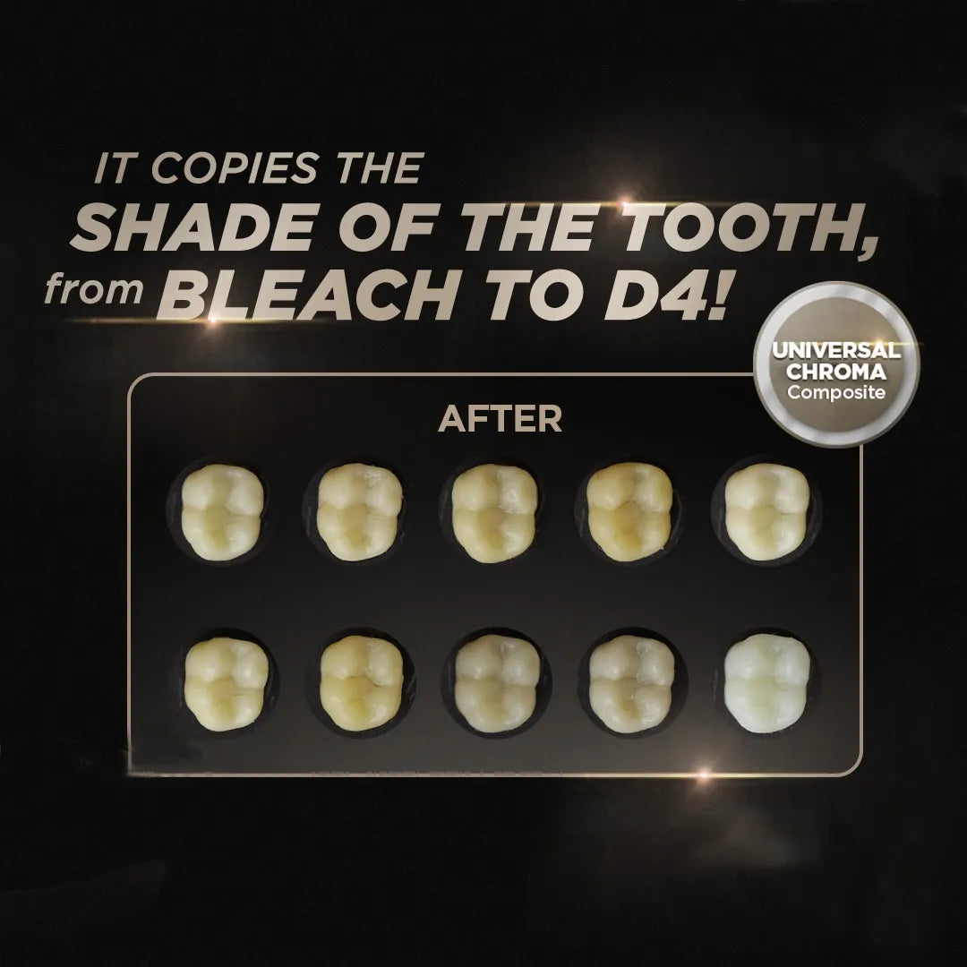 FGM Vittra APS Unique Composite