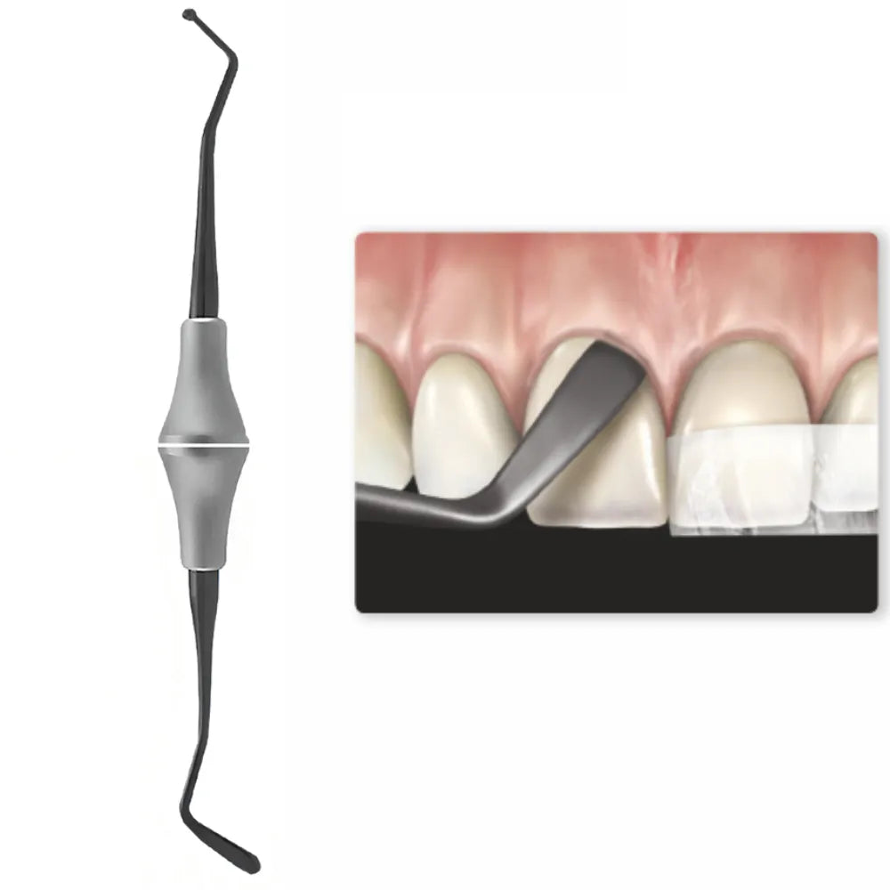 GDC Teflon Coated Composite Anterior Placing (Tncipcl)