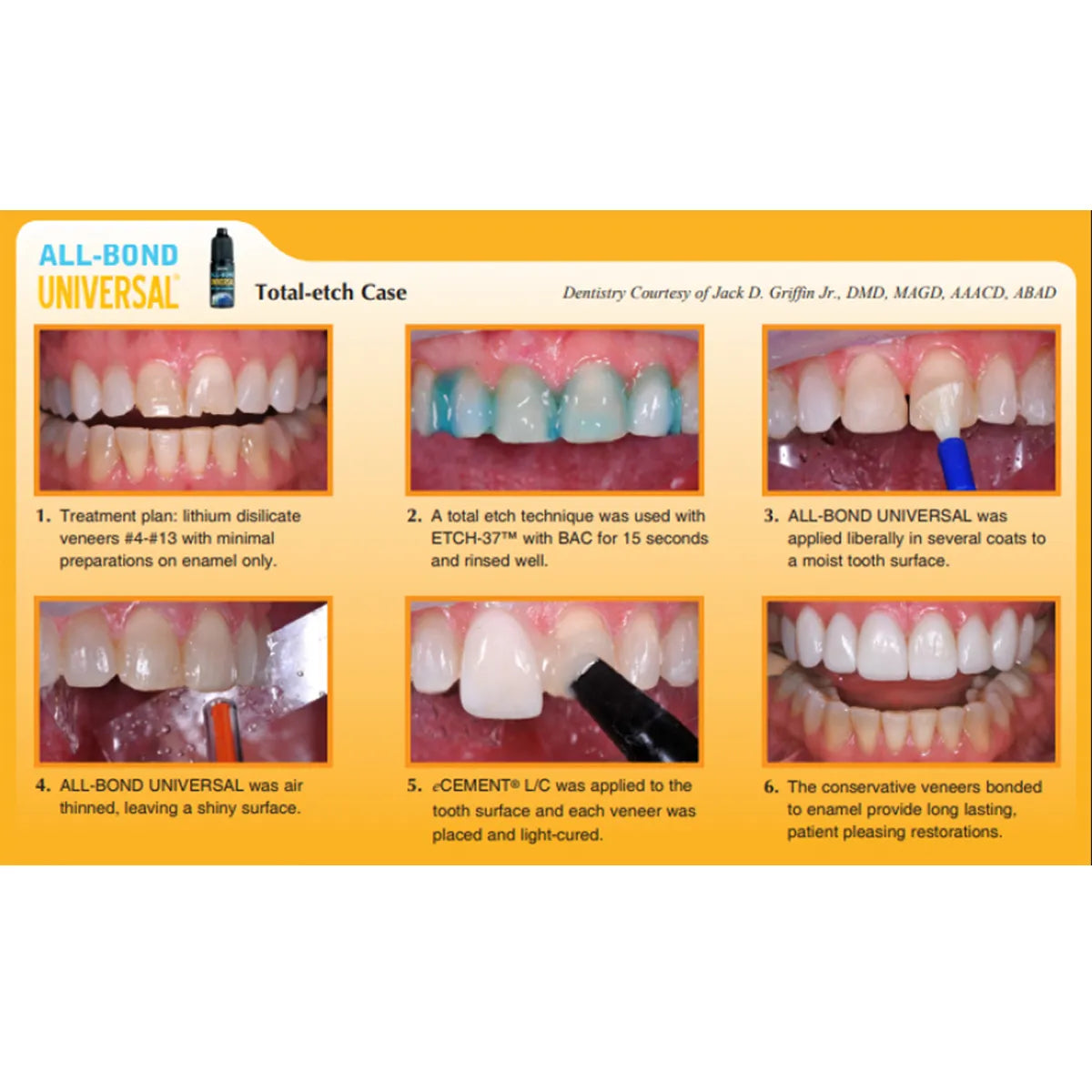 Bisco All Bond Universal LC Adhesive 4ml