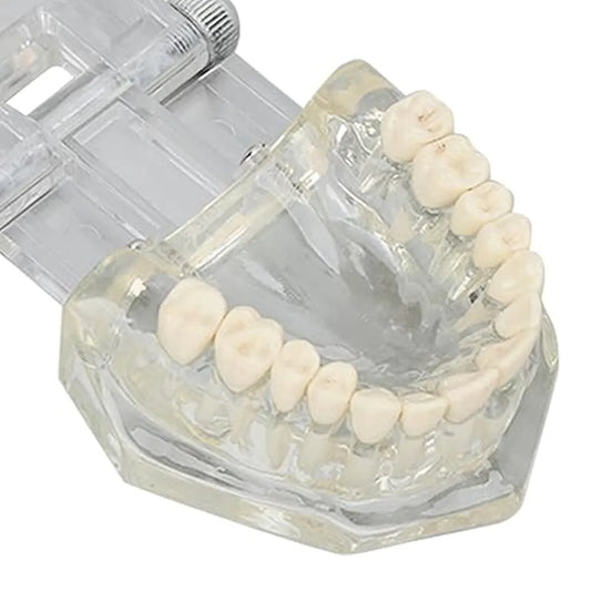 JJ Ortho Class II Division II Orthodontic Model (10.10.03)