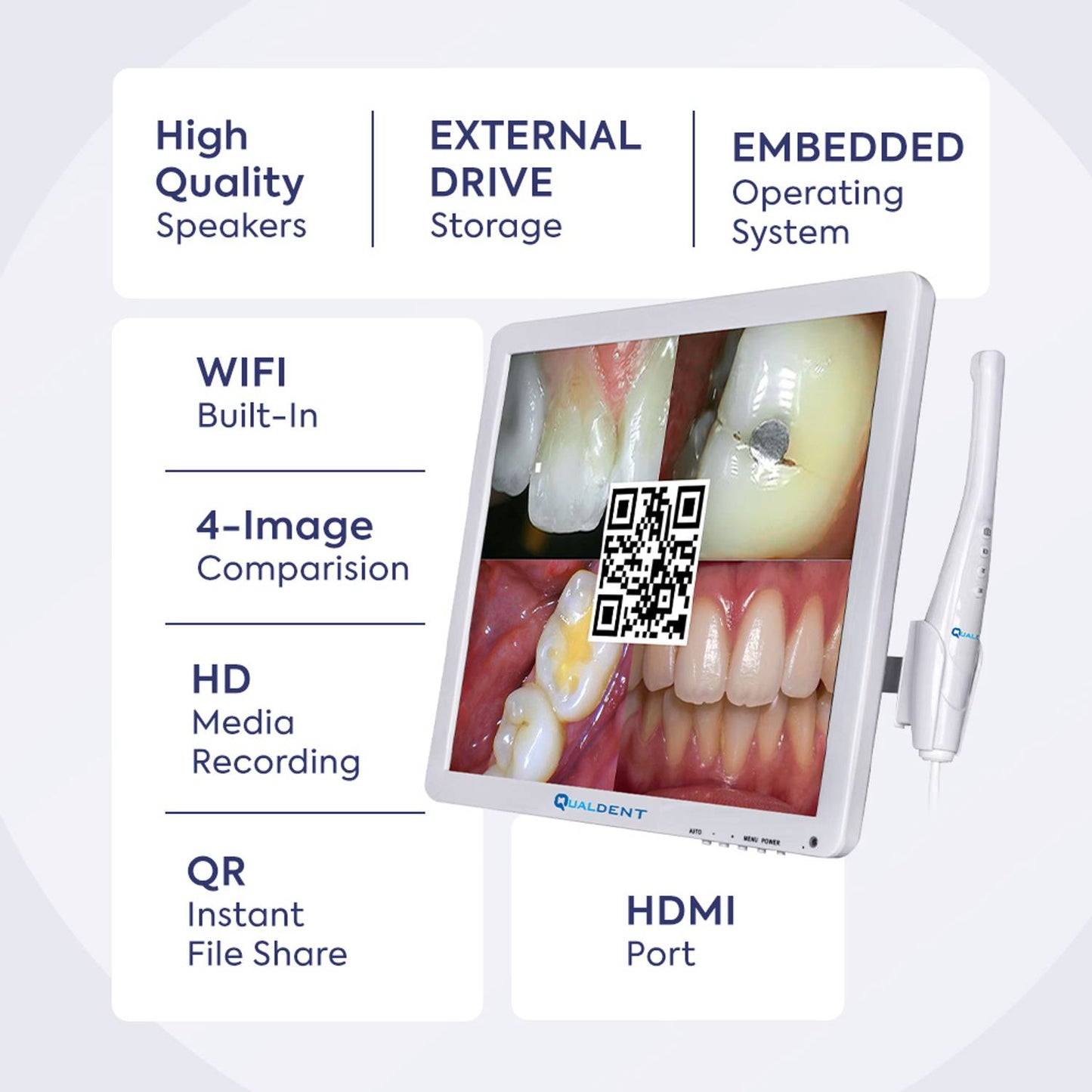 Qualdent Classic+ 16MP Intraoral Camera with Screen & In-Built Wi-Fi