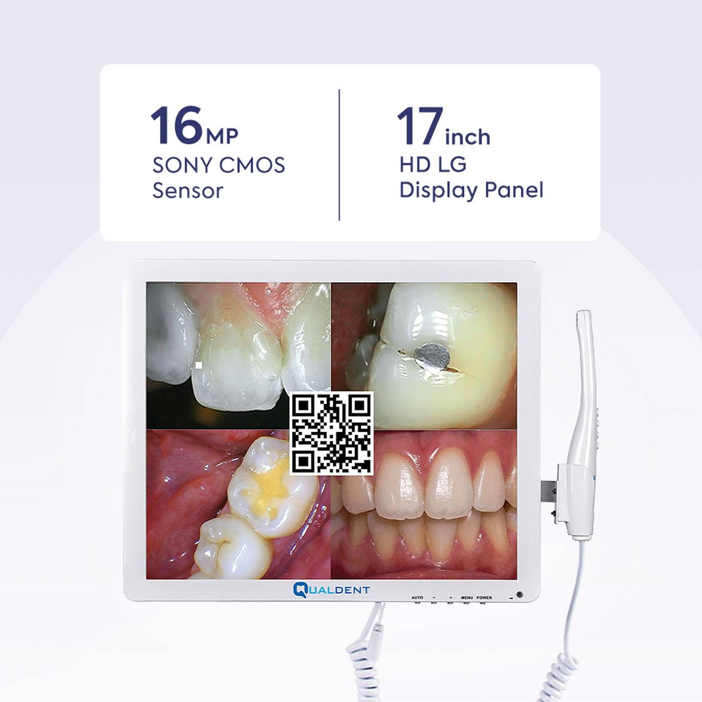 Qualdent Classic+ 16MP Intraoral Camera with Screen & In-Built Wi-Fi