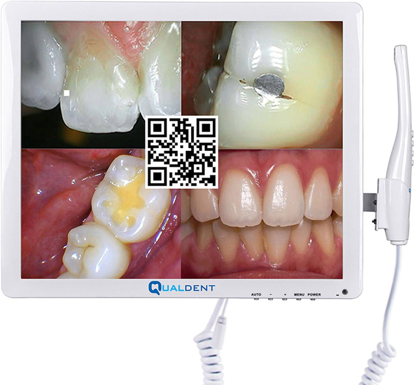 Qualdent Classic+ 16MP Intraoral Camera with Screen & In-Built Wi-Fi