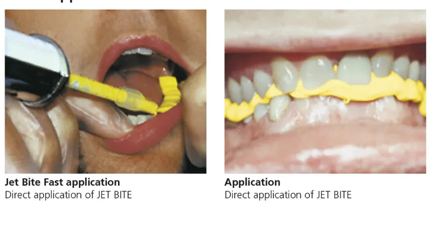 Coltene Jet Bite