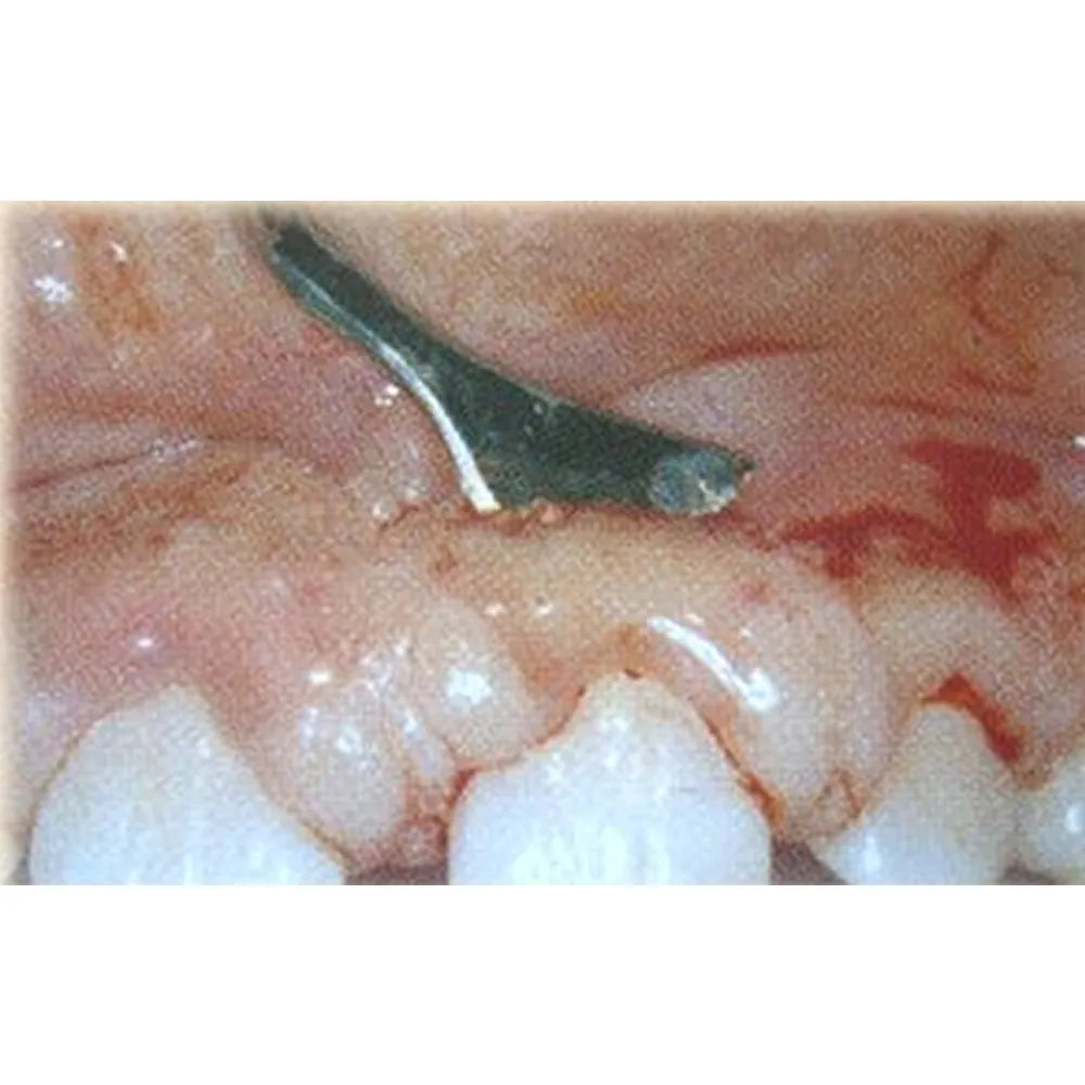 GDC Crane Kaplan Knife #6 (Kck3)