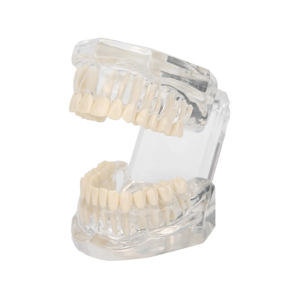 JJ Ortho Class II Division I Orthodontic Model (10.10.02)