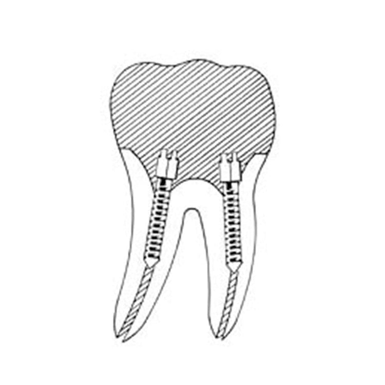 Denmax Gold Metal Posts