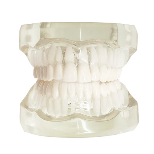 JJ Ortho Class II Division I Orthodontic Model (10.10.02)