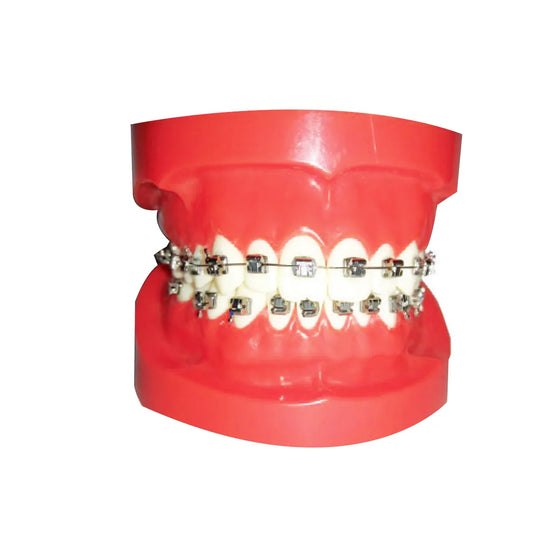 JJ Ortho Orthodontic Model With Selfy Passive Metal Self Ligating Brackets (10.10.07)