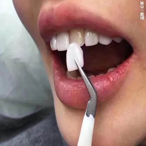 Endoking Preformed Temporary Crowns