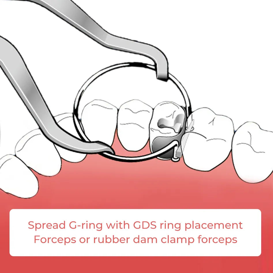 ET Dental Sectional Contoured Matrices Kit