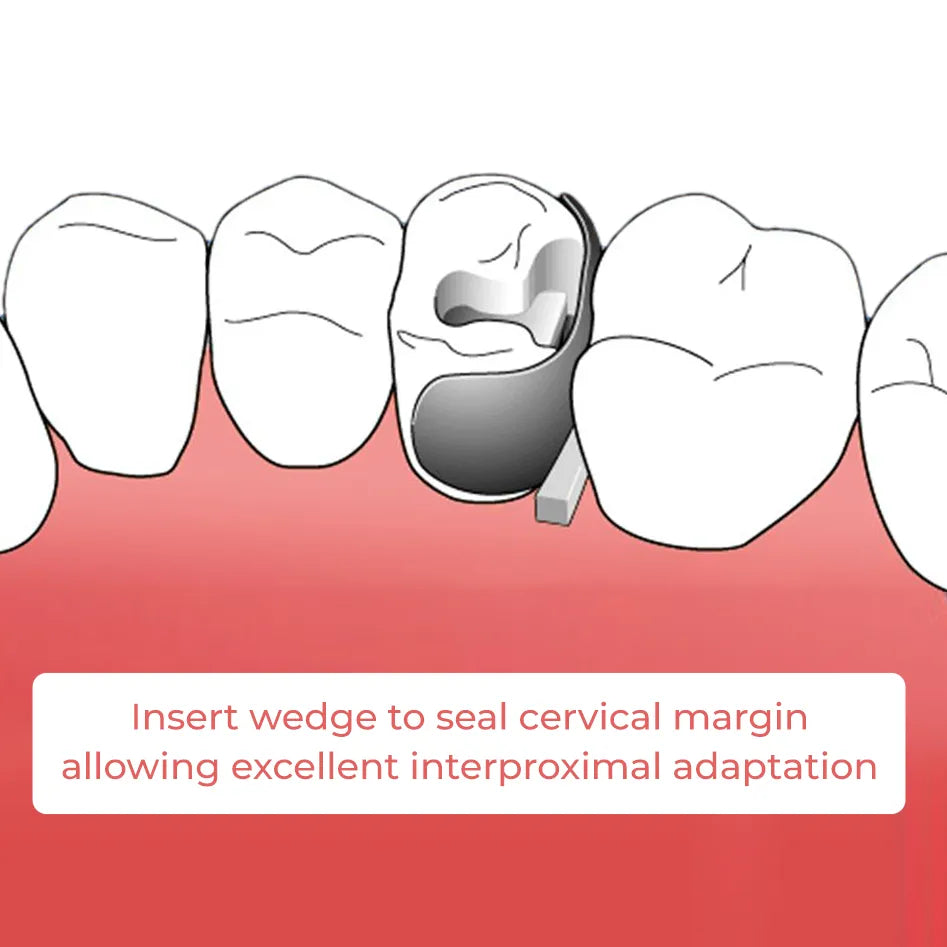 ET Dental Sectional Contoured Matrices Kit