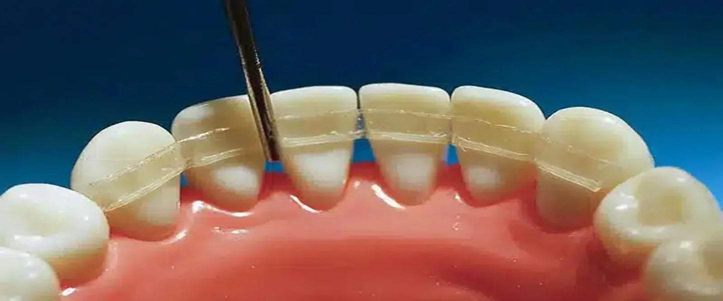 DentAct Fiber Splint 14cm