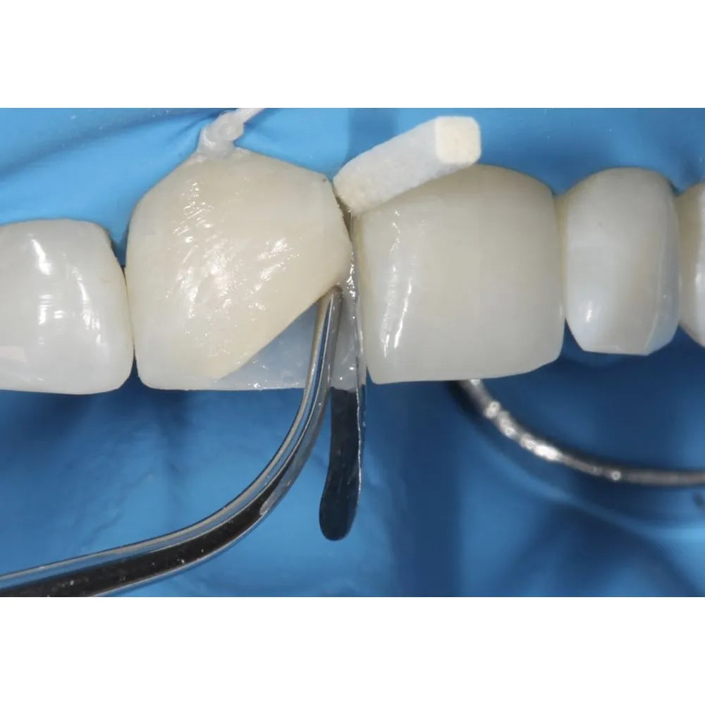 GDC Restore Instrument - Fissura