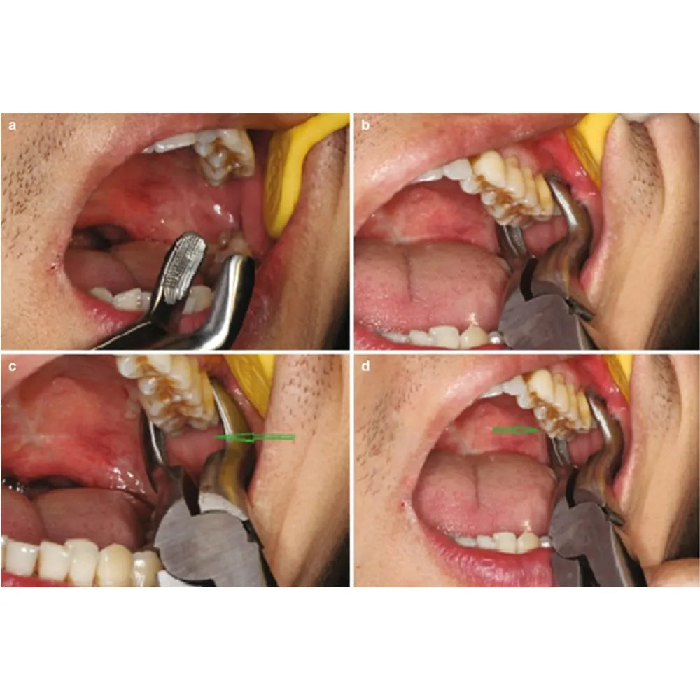 GDC Extraction Forceps Upper Third Molars - 67a Standard (Fx67as)