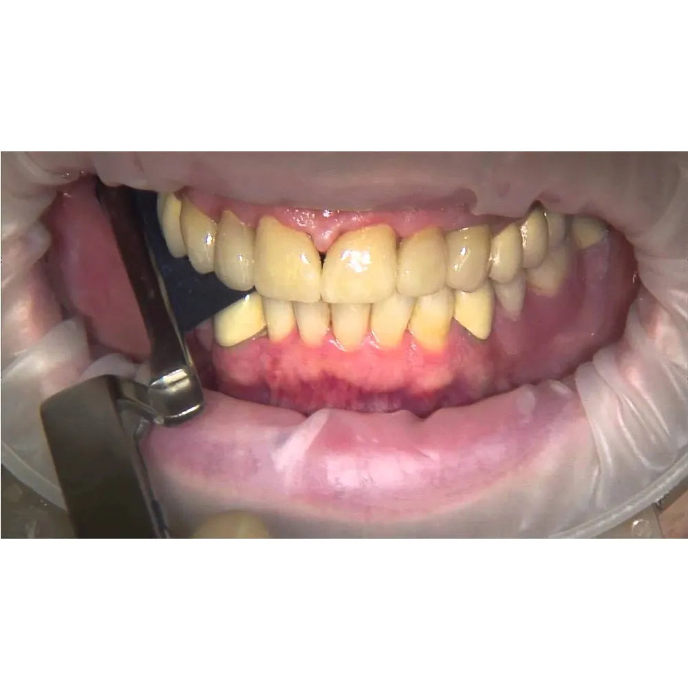 GDC Dental Articulating Paper Holder APF2E Miller