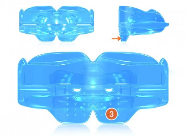 MRC Myobrace For Kids -K1 & K2