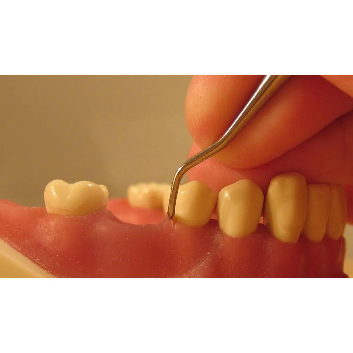 American Eagle Universal Blackjack Scalers With XP Technology