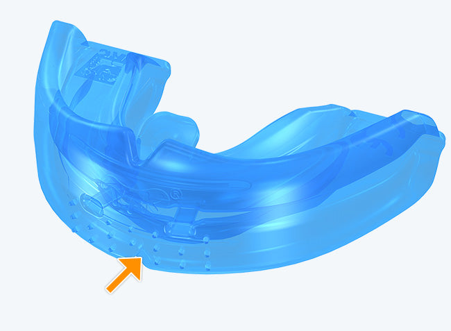 MRC Trainer T4K for Kids Pre-Orthodontic Appliance