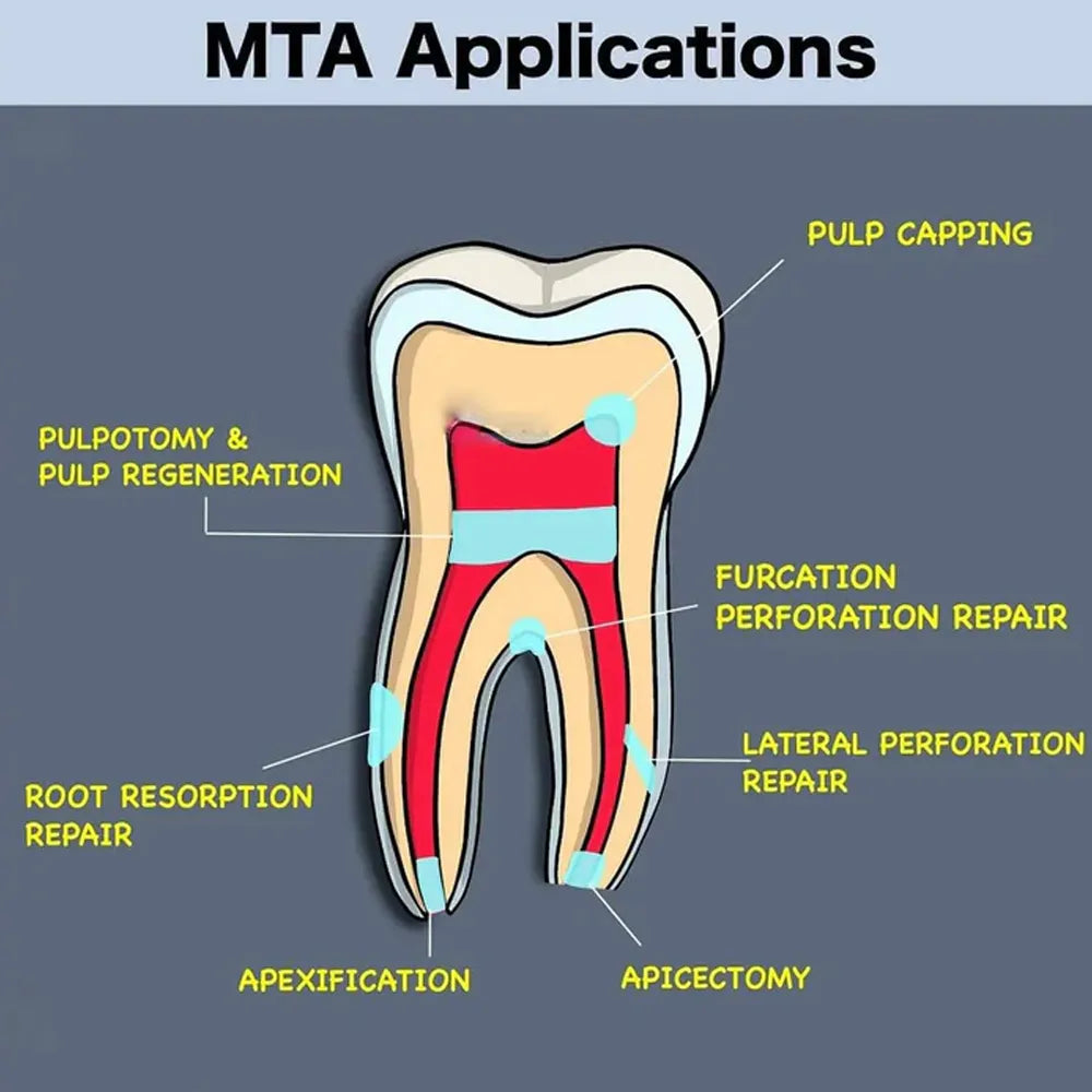 Prime Dental MTA Bio Putty