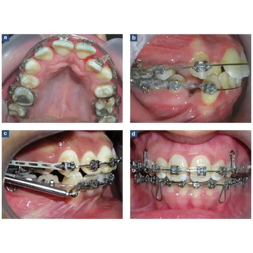 OSL E Chain 15ft Spools Short