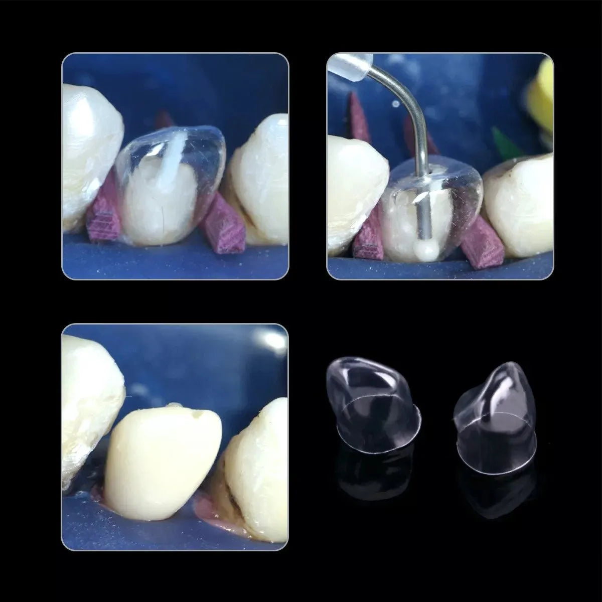 Tor Vm Transparent Crowns