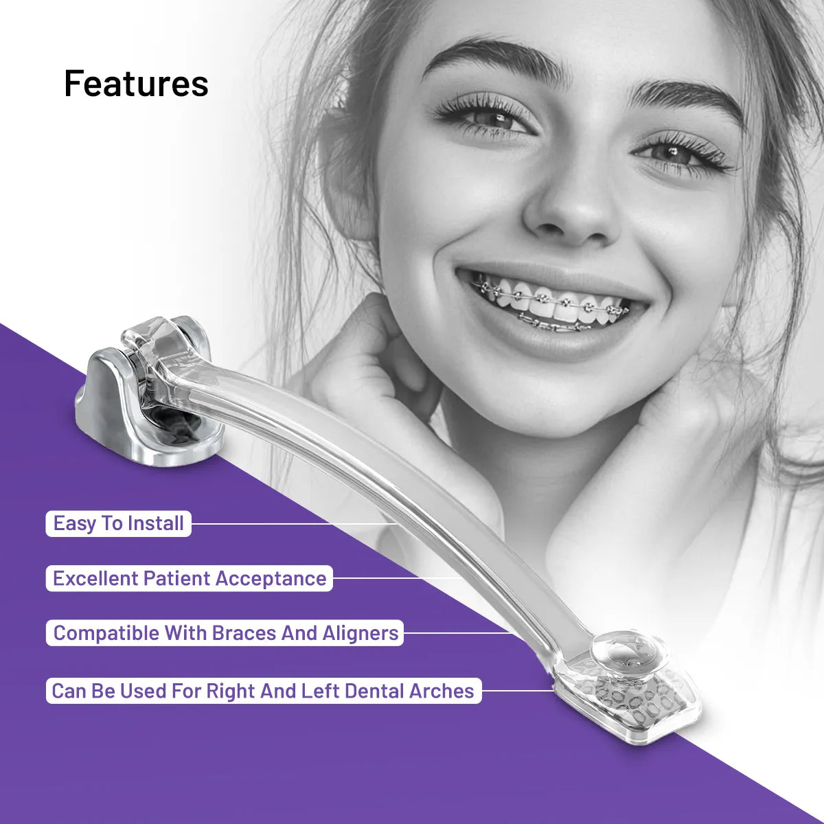 OrthoMetric Iceram Clear Distalizer (2/Pk)