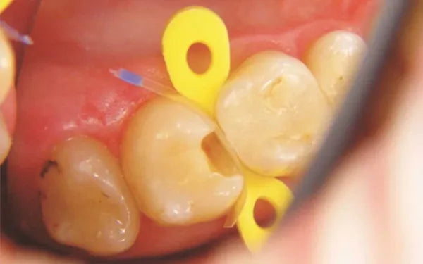 Tor Vm Transparent Sectional Contoured Matrices