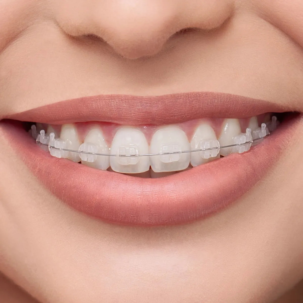 OrthoMetric Flexy NiTi Super Elastic Archwire - Round (10/Pk)