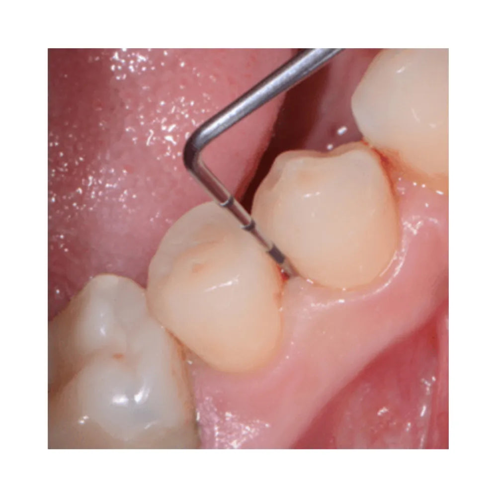 GDC Single End Probes Screening Probe (Who Probe) #6 (Pcp11.5b)