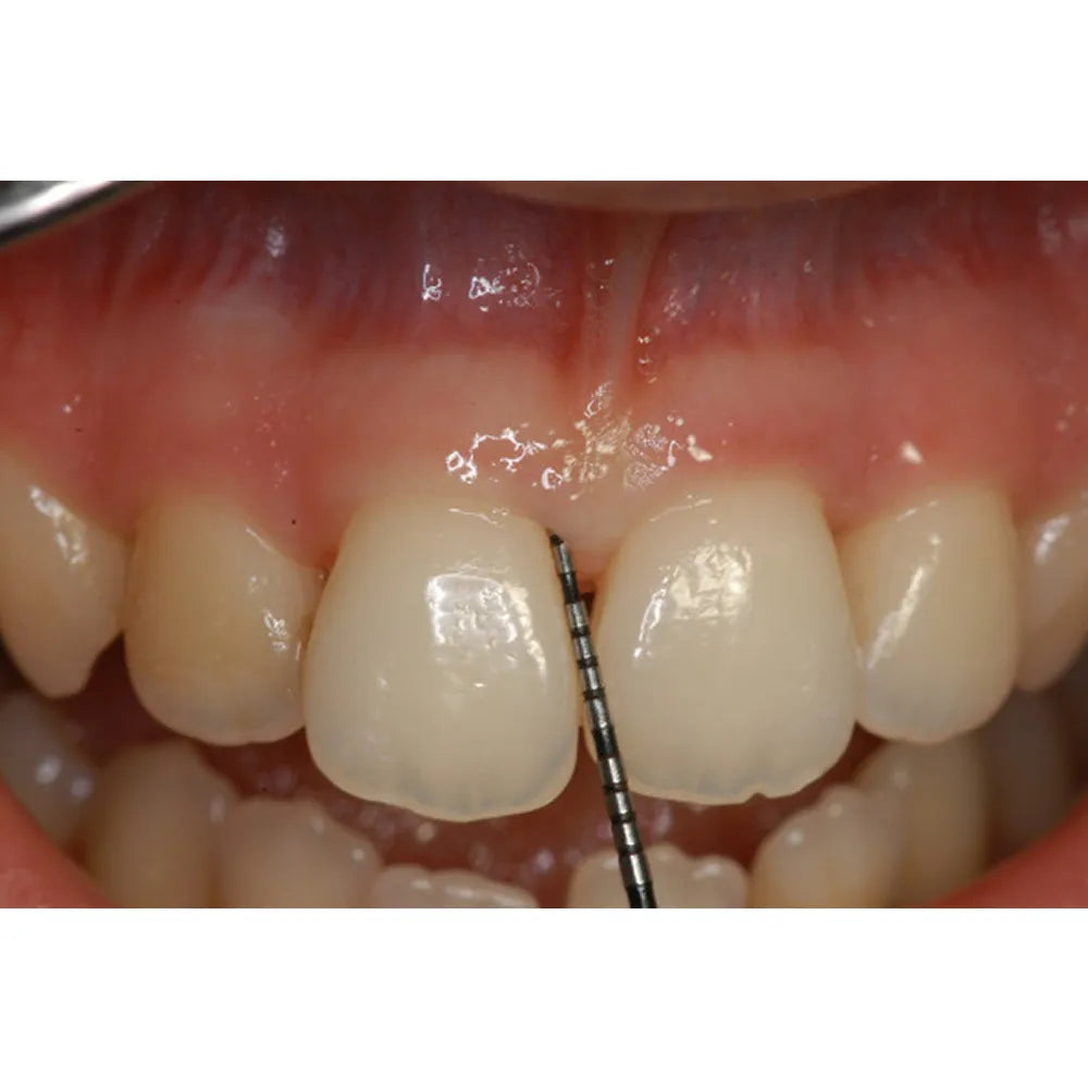 GDC Double End Probes Thin William / Screening Probe # 6 (Pcpqow/11.5b)