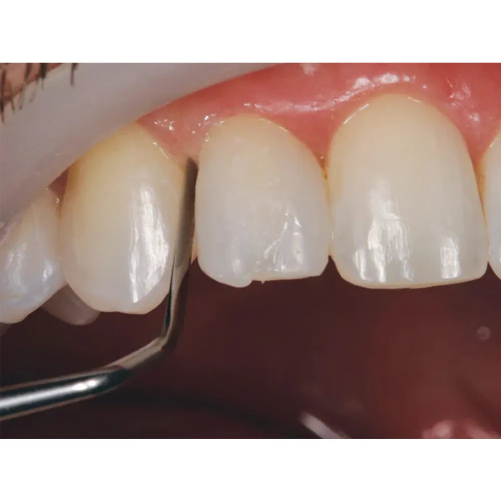 GDC Heidemann Spatula # 6 (PFIHS1)