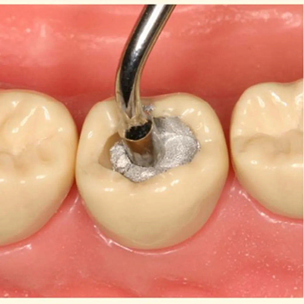 GDC Plugger/Condenser Serrated - # 4 PLG2