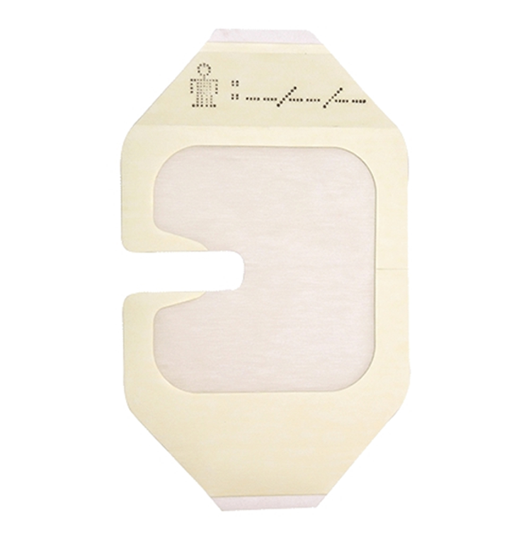 Romsons Intra Shield Transparent Cannula Fixator - Pack of 100 (GS-3045)