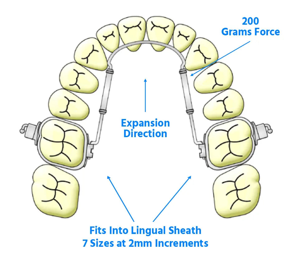 Ortho Organizers Transforce Sagittal Appliance