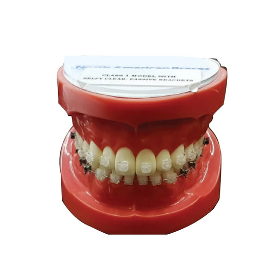 JJ Ortho Orthodontic Model With Selfy Clear Self Ligating Bracket (10.10.09)