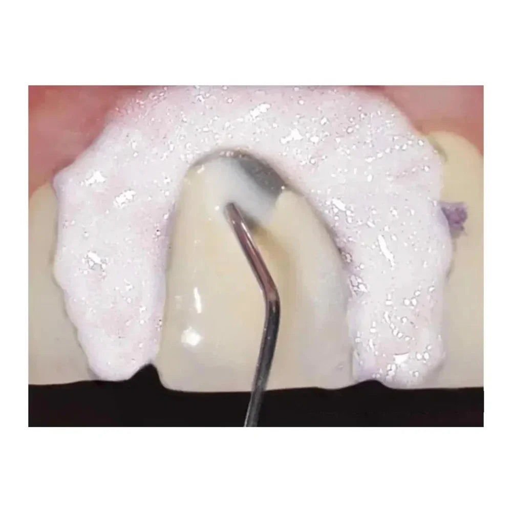 Ultradent PermaFlo A2 Refill