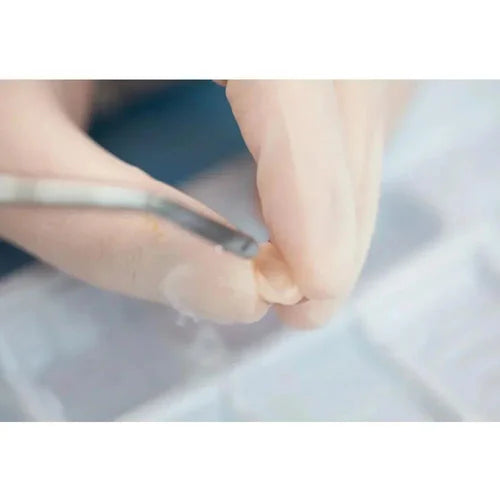 Vincismile HF-Etchant Hydrofluoric Acid Etching Gel