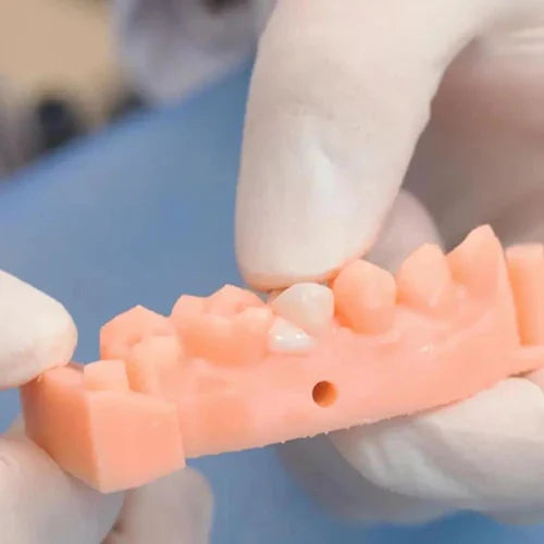 Vincismile TopCEM Dual Cure Resin Cement