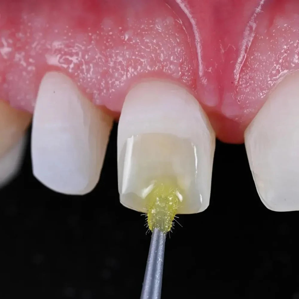 Voco Bifix SE Self-Adhesive Resin Cement