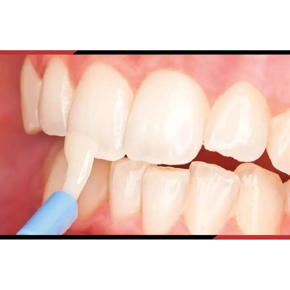 Voco Bifluorid 10 Fluoride Varnish