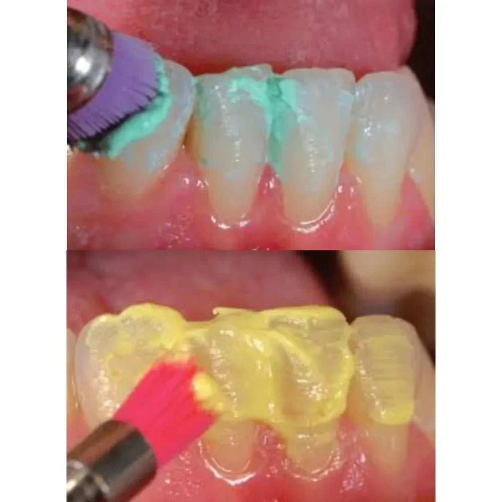 Voco Clean Joy Prophylaxis Paste