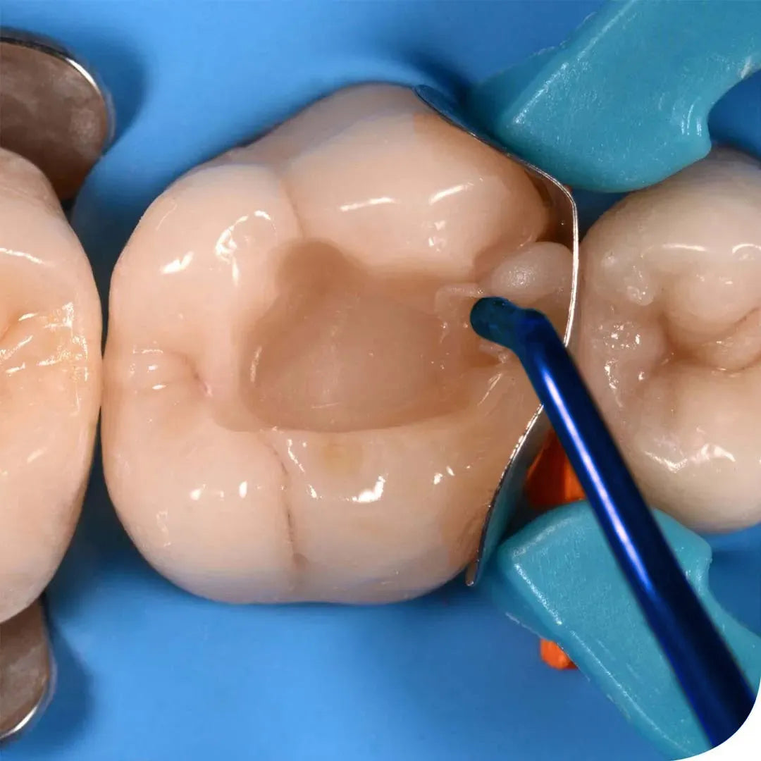 GDC Composite Instrument Blue Titanium - 6 Cib2