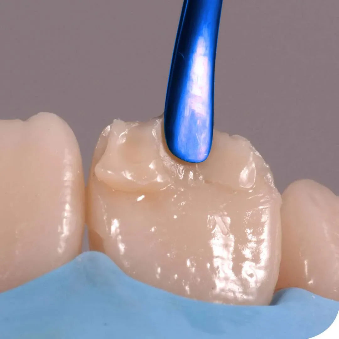 DentGist NanoCom Restorative Composite Refills 4g